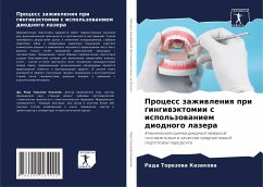 Process zazhiwleniq pri gingiwäktomii s ispol'zowaniem diodnogo lazera - Kazakowa, Rada Torezowa