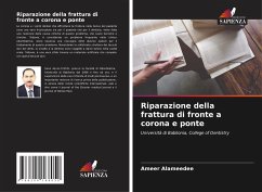 Riparazione della frattura di fronte a corona e ponte - Alameedee, Ameer