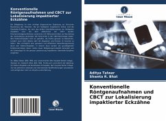 Konventionelle Röntgenaufnahmen und CBCT zur Lokalisierung impaktierter Eckzähne - Talwar, Aditya;Bhat, Shweta R.