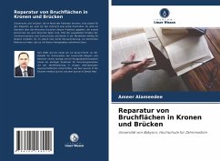 Reparatur von Bruchflächen in Kronen und Brücken - Alameedee, Ameer