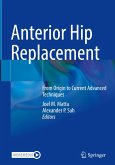 Anterior Hip Replacement