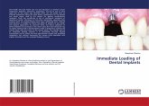 Immediate Loading of Dental Implants