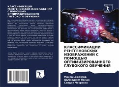 KLASSIFIKACII RENTGENOVSKIH IZOBRAZhENIJ S POMOShh'Ju OPTIMIZIROVANNOGO GLUBOKOGO OBUChENIYa - Dzhangid, Mahesh;Panda, Shubhadzhit;Chaurasia, Sandip