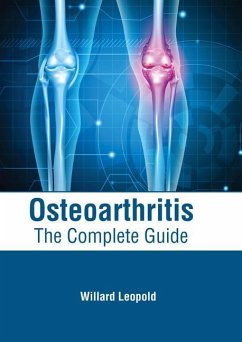 Osteoarthritis: The Complete Guide