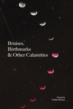 Bruises, Birthmarks & Other Calamities - Klassen, Nadine