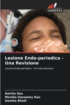 Lesione Endo-periodica - Una Revisione - Das, Amrita;GOSWAMY RAO, MONIKA;BHATT, GEETHA