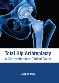 Total Hip Arthroplasty: A Comprehensive Clinical Guide