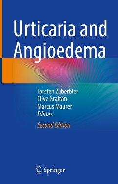 Urticaria and Angioedema (eBook, PDF)