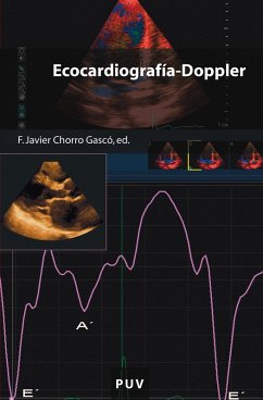Ecocardiografía-Doppler (eBook, ePUB) - Autores Varios