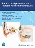 Tratado de implante coclear e próteses auditivas implantáveis (eBook, ePUB)