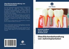 Oberflächenbehandlung von Zahnimplantaten - Jadhav, Hemant;Shetty, Uttam;Joshi, Mridula