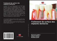 Traitement de surface des implants dentaires - Jadhav, Hemant;Shetty, Uttam;Joshi, Mridula