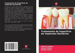 Tratamento de Superfície de Implantes Dentários - Jadhav, Hemant;Shetty, Uttam;Joshi, Mridula