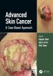 Advanced Skin Cancer - Bild 1