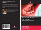 Maloclusão de Classe II em Crianças