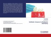 Esthetic Crowns in Pediatric Dentistry