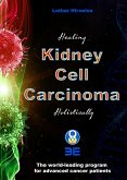 Kidney Cell Carcinoma (eBook, ePUB)