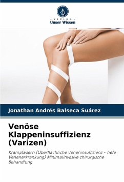 Venöse Klappeninsuffizienz (Varizen) - Balseca Suárez, Jonathan Andrés