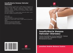 Insuficiência Venosa Valvular (Varizes) - Balseca Suárez, Jonathan Andrés