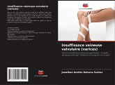 Insuffisance veineuse valvulaire (varices)