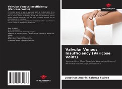 Valvular Venous Insufficiency (Varicose Veins) - Balseca Suárez, Jonathan Andrés