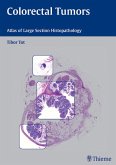 Colorectal Tumors (eBook, ePUB)