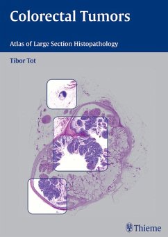Colorectal Tumors (eBook, ePUB) - Tot, Tibor