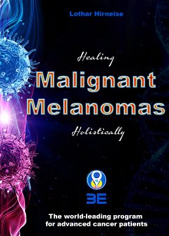 Malignant Melanomas (eBook, ePUB) - Hirneise, Lothar