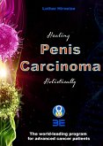 Penis carcinoma (eBook, ePUB)