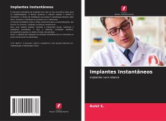 Implantes Instantâneos - S., Rohit