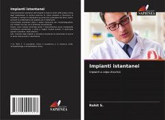 Impianti istantanei - S., Rohit