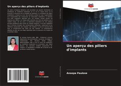 Un aperçu des piliers d'implants - Paulose, Anoopa