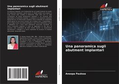 Una panoramica sugli abutment implantari - Paulose, Anoopa