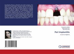 Peri Implantitis - Kour Mehta, Navneet;Irshad Wani, Nadia;Ahmad Hela, Hilal