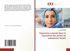 Expansion cutanée dans la réparation des pertes de substances faciale - Naija, Sonia;Chebbi, Ghassen