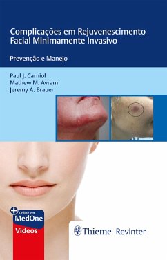 Cover Complicações em Rejuvenescimento Facial Minimamente Invasivo (eBook, ePUB)