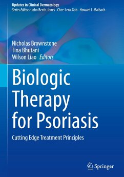 Biologic Therapy for Psoriasis