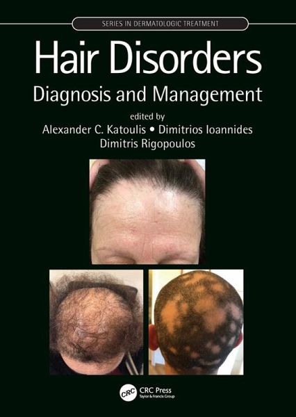 Hair Disorders (eBook, ePUB) Hair Disorders (eBook, ePUB)