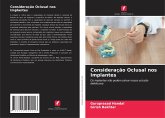 Consideração Oclusal nos Implantes