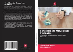 Consideração Oclusal nos Implantes - Handal, Guruprasad;Bakhtar, Girish