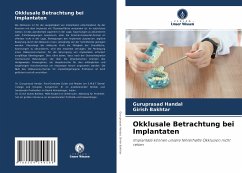 Okklusale Betrachtung bei Implantaten - Handal, Guruprasad;Bakhtar, Girish