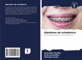 Alambres de ortodoncia