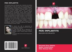 Cover PERI IMPLANTITE