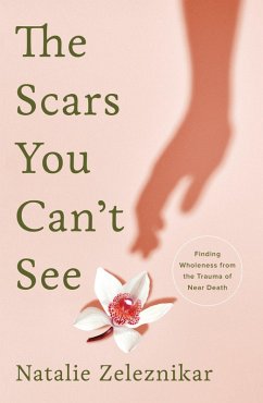 The Scars You Can't See: Finding Wholeness from the Trauma of Near Death (eBook, ePUB) - Zeleznikar, Natalie