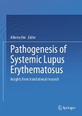 Pathogenesis of Systemic Lupus Erythematosus (eBook, PDF)