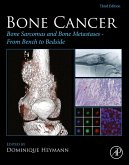 Bone Cancer (eBook, ePUB)