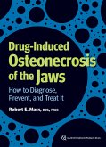 Drug-Induced Osteonecrosis of the Jaws (eBook, PDF)