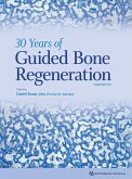 30 Years of Guided Bone Regeneration (eBook, ePUB)