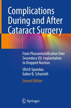 Complications During and After Cataract Surgery - Spandau, Ulrich;Scharioth, Gabor B.
