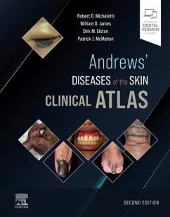 Andrews' Diseases of the Skin Clinical Atlas - Micheletti, Robert G., MD (Assistant Professor of Dermatology, Depar; James, William D., MD (Paul R. Gross Professor of Dermatology, Depar; Elston, Dirk M. (Professor and Chairman, Department of Dermatology a